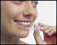 GIlbert Invisalign, Mesa Invisalign, Invisalign Gilbert, Invisalign Mesa