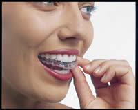 Mesa Invisalign, Gilbert Invisalign